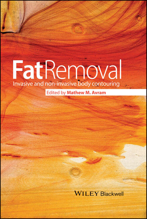 Book cover of Fat Removal