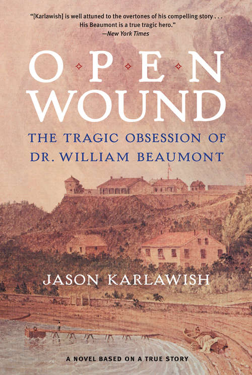 Book cover of Open Wound: The Tragic Obsession of Dr. William Beaumont