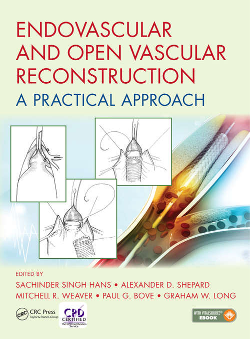 Book cover of Endovascular and Open Vascular Reconstruction: A Practical Approach