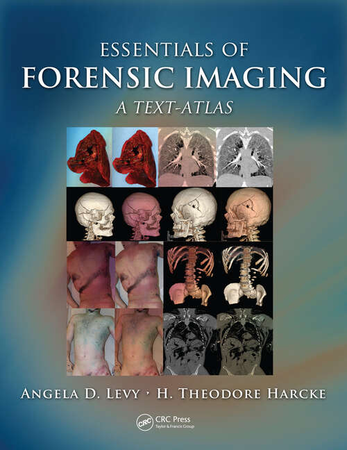 Book cover of Essentials of Forensic Imaging: A Text-Atlas