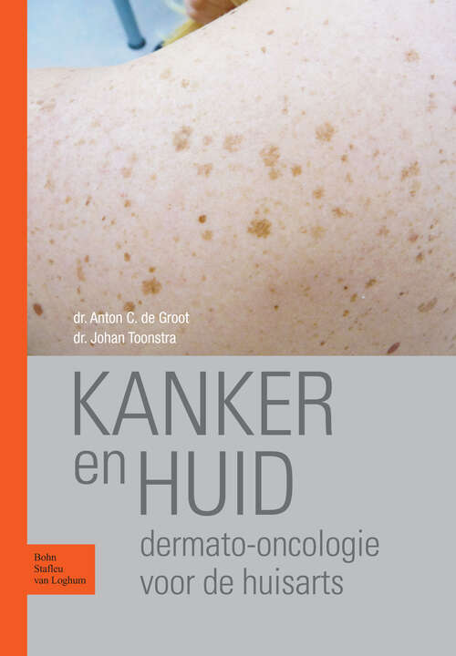 Book cover of Kanker en huid: Dermato-oncologie voor de huisarts (2010)