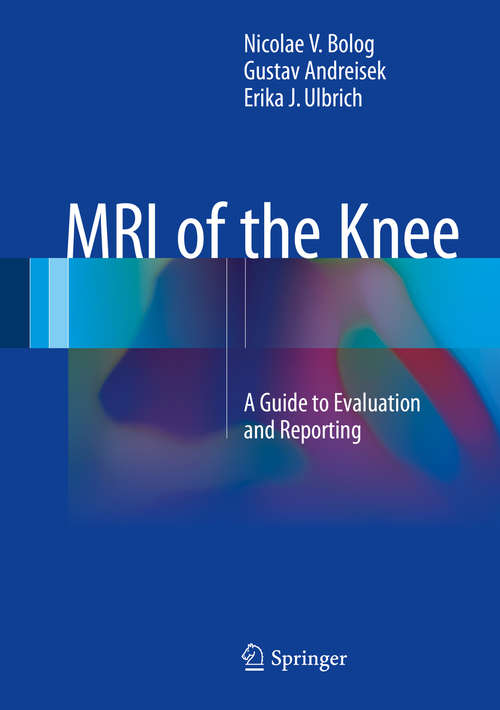 Book cover of MRI of the Knee