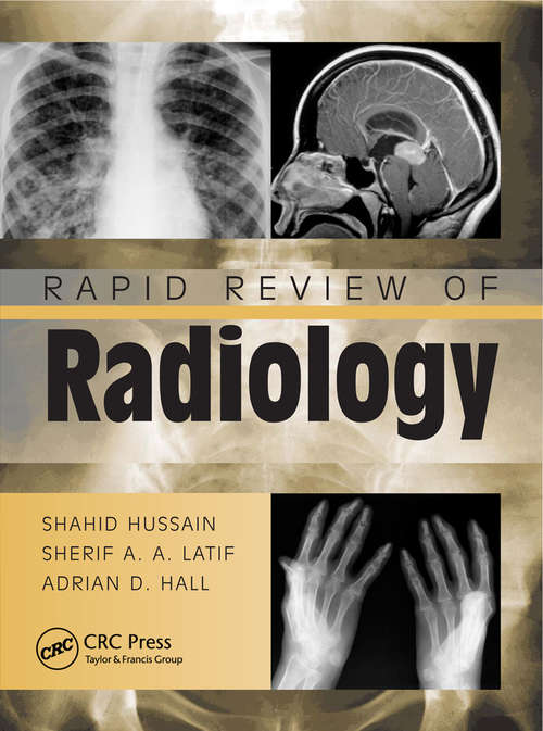 Rapid Review of Radiology (Medical Rapid Review Ser.)