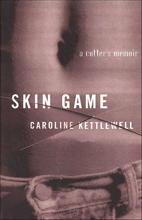 Book cover of Skin Game: A Cutter's Memoir