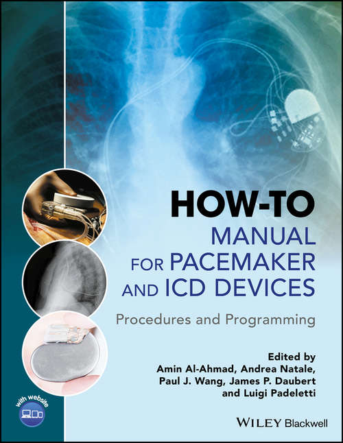 How-to Manual for Pacemaker and ICD Devices: Procedures and Programming
