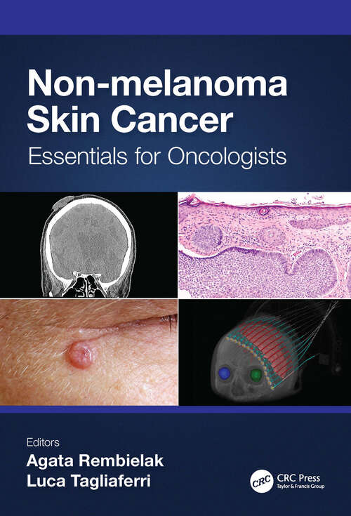 Book cover of Non-melanoma Skin Cancer: Essentials for Oncologists