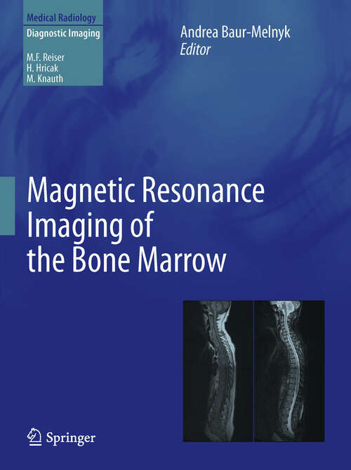Book cover of Magnetic Resonance Imaging of the Bone Marrow