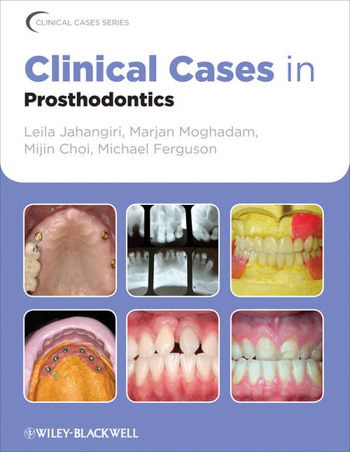 Clinical Cases in Prosthodontics (Clinical Cases (Dentistry) #9)