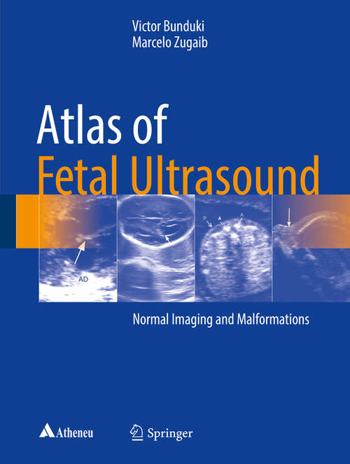 Book cover of Atlas of Fetal Ultrasound