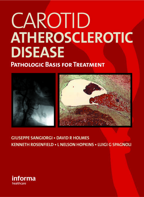 Book cover of Carotid Atherosclerotic Disease: Pathologic Basis for Treatment
