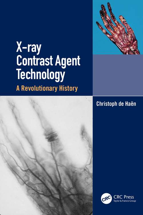 Book cover of X-ray Contrast Agent Technology: A Revolutionary History