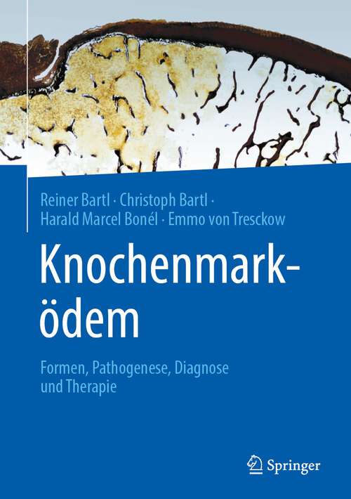 Book cover of Knochenmarködem: Formen, Pathogenese, Diagnose und Therapie (1. Aufl. 2023)