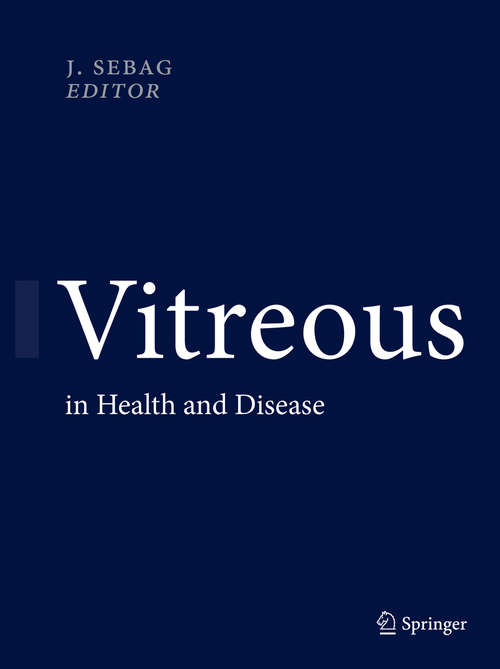 Book cover of Vitreous
