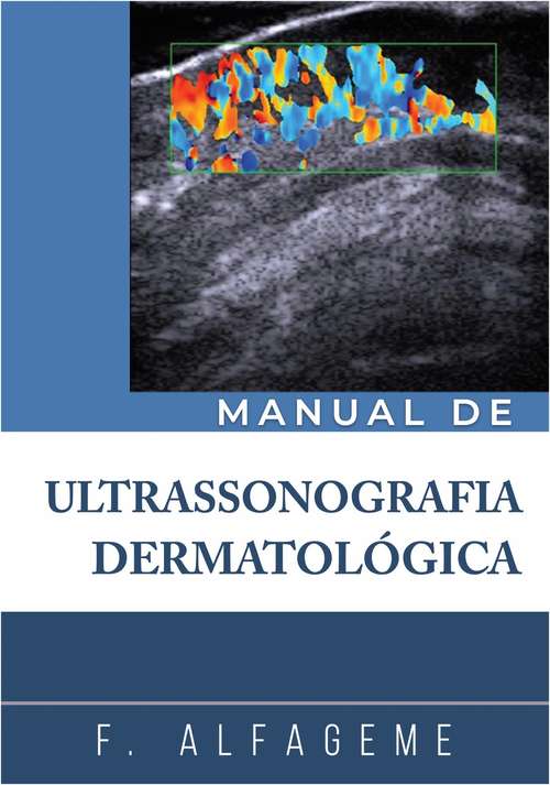 Book cover of Manual de Ultrassonografia Dermatológica