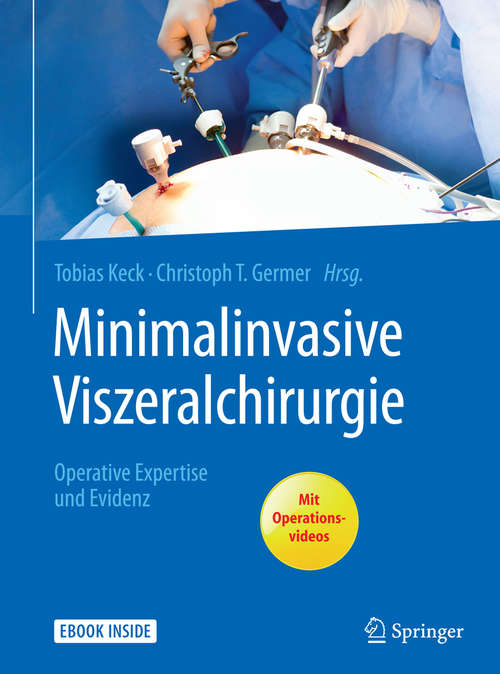 Minimalinvasive Viszeralchirurgie