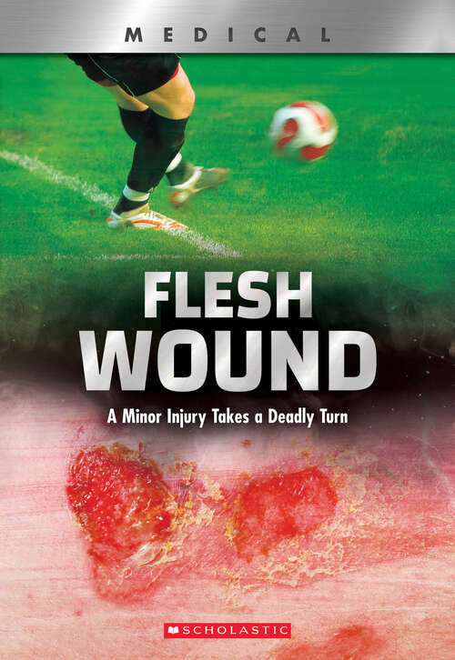 Book cover of Flesh Wound: A Minor Injury Takes a Deadly Turn (XBooks: Medical)