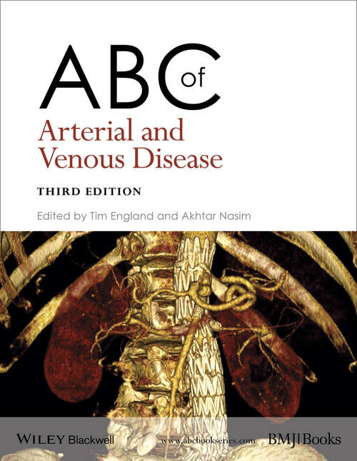 Book cover of ABC of Arterial and Venous Disease