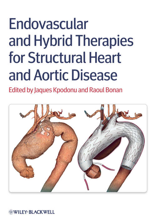 Book cover of Endovascular and Hybrid Therapies for Structural Heart and Aortic Disease