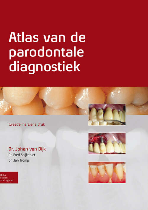 Book cover of Atlas van de parodontale diagnostiek