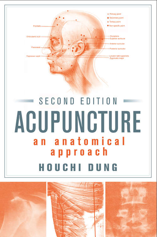 Cover image of Acupuncture