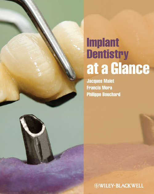 Implant Dentistry at a Glance (At a Glance #60)