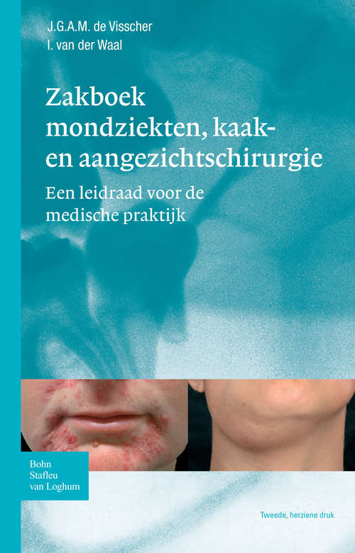 Book cover of Zakboek mondziekten, kaak- en aangezichtschirurgie