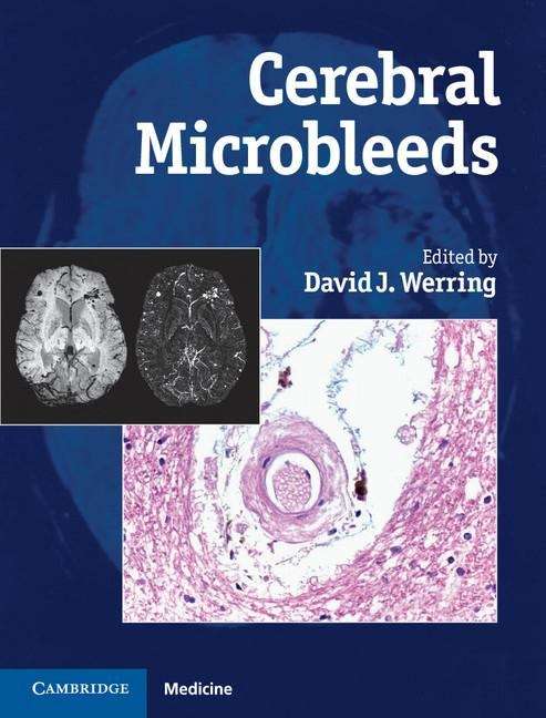 Book cover of Cerebral Microbleeds