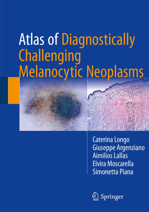 Book cover of Atlas of Diagnostically Challenging Melanocytic Neoplasms