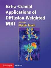 Book cover of Extra-Cranial Applications of Diffusion-Weighted MRI