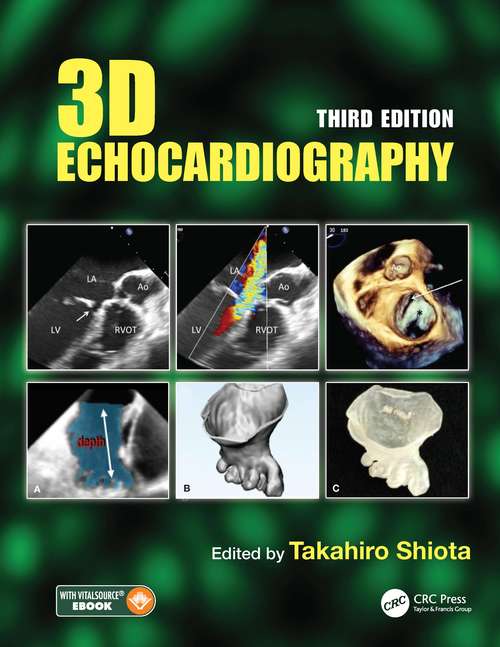 Book cover of 3D Echocardiography (3)
