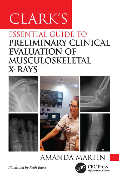 Book cover of Clark’s Essential Guide to Preliminary Clinical Evaluation of Musculoskeletal X-rays (1) (Clark's Companion Essential Guides)