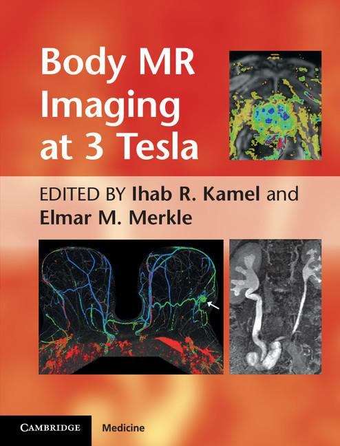Book cover of Body MR Imaging at 3.0 Tesla