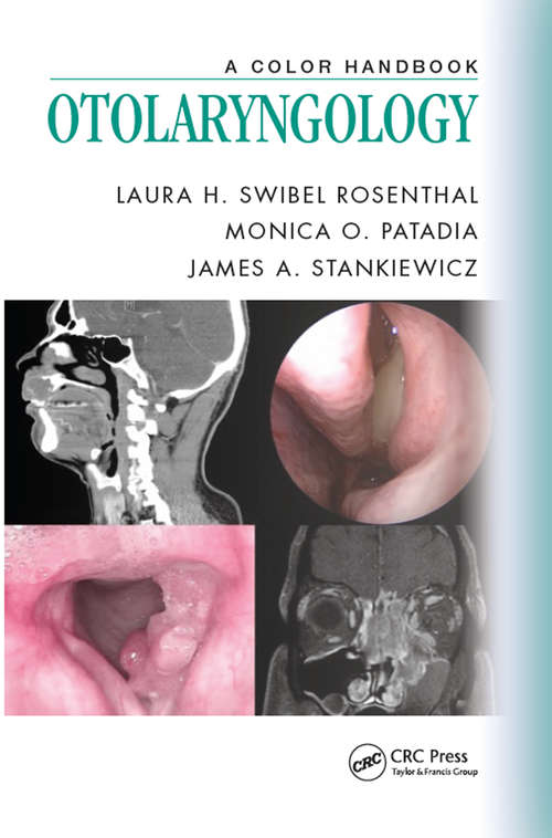 Otolaryngology: A Color Handbook (Medical Color Handbook Series)