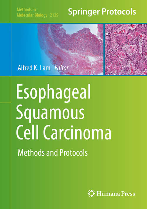 Esophageal Squamous Cell Carcinoma: Methods and Protocols (Methods in Molecular Biology #2129)