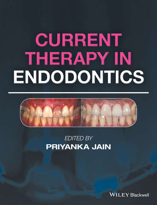 Book cover of Current Therapy in Endodontics