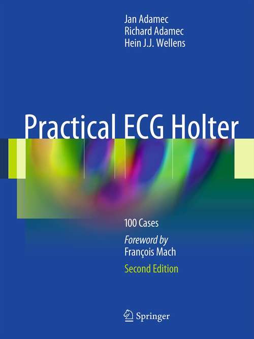 Practical ECG Holter