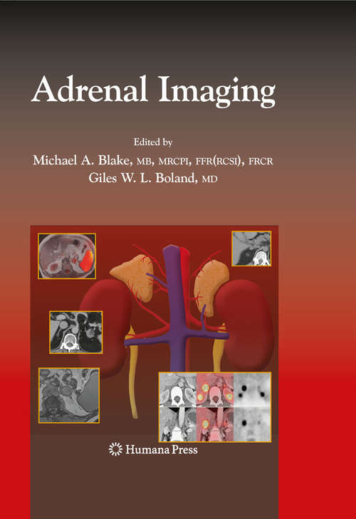 Adrenal Imaging (Contemporary Medical Imaging)