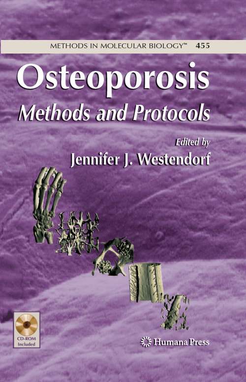 Book cover of Osteoporosis