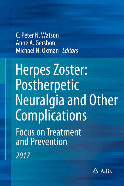 Herpes Zoster: Focus On Treatment And Prevention