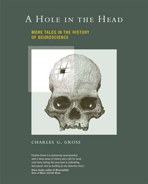 Book cover of A Hole in the Head