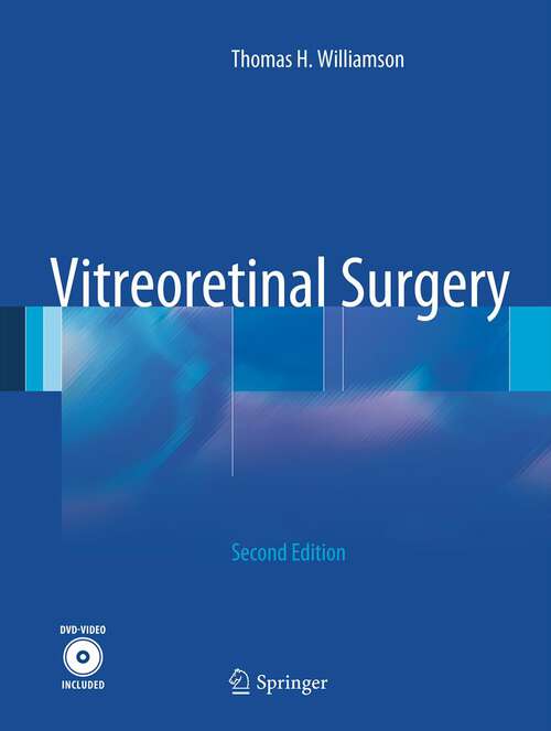 Book cover of Vitreoretinal Surgery
