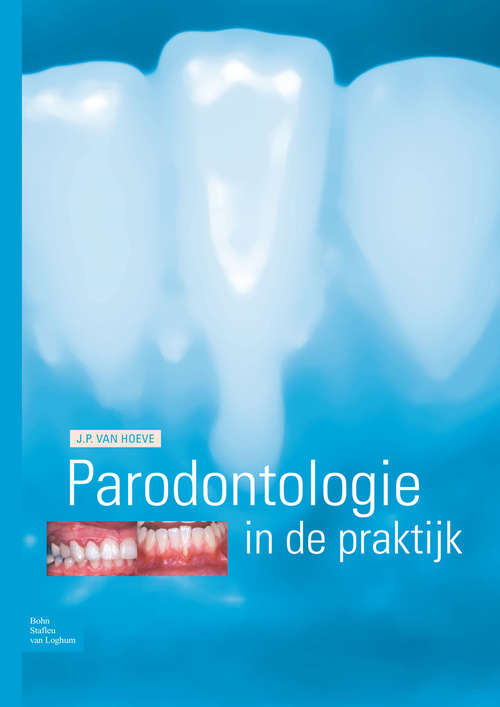 Book cover of Parodontologie in de Praktijk (2009)