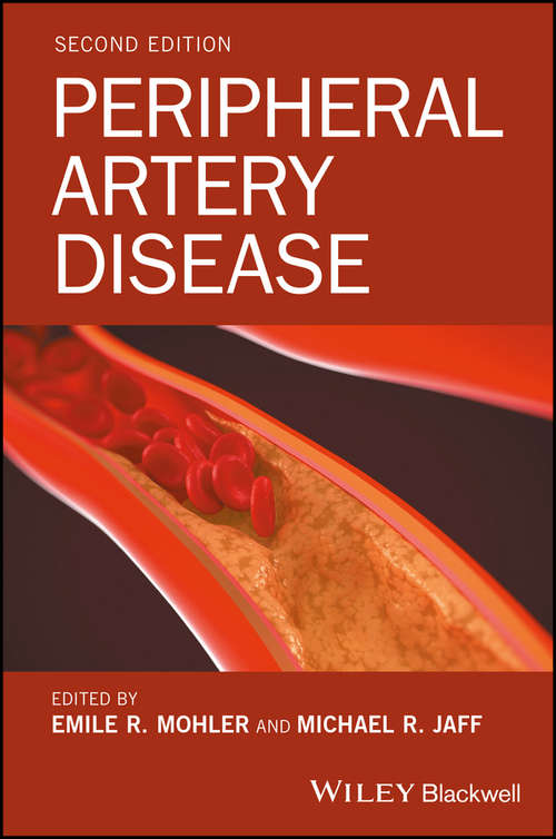 Book cover of Peripheral Artery Disease