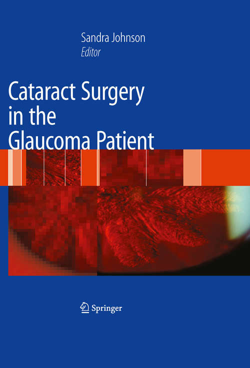 Book cover of Cataract Surgery in the Glaucoma Patient