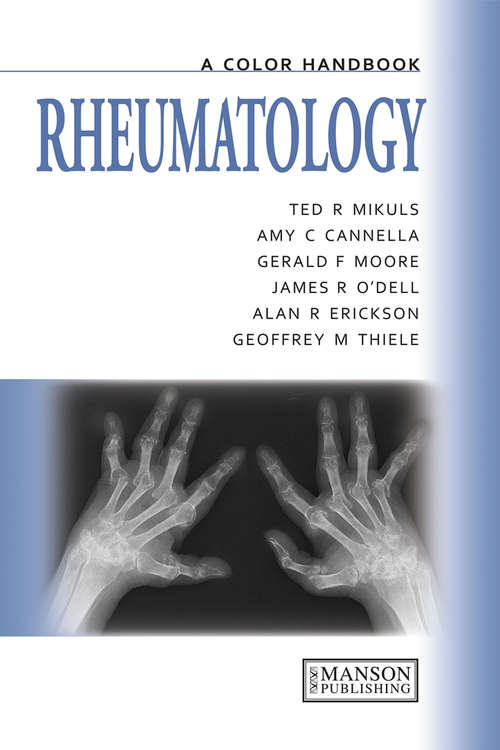 Rheumatology: A Color Handbook (Medical Color Handbook Ser.)