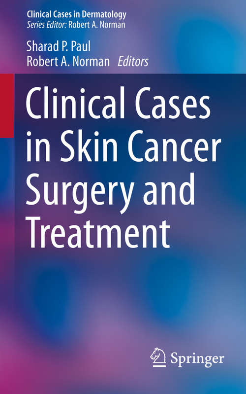 Clinical Cases in Skin Cancer Surgery and Treatment (Clinical Cases in Dermatology)