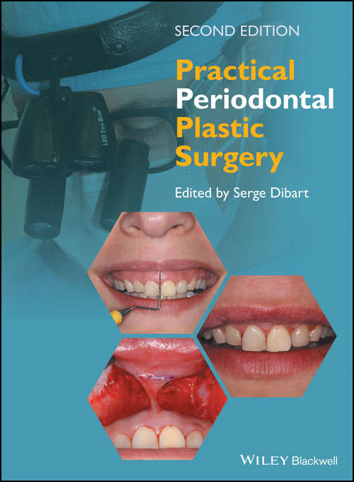 Book cover of Practical Periodontal Plastic Surgery