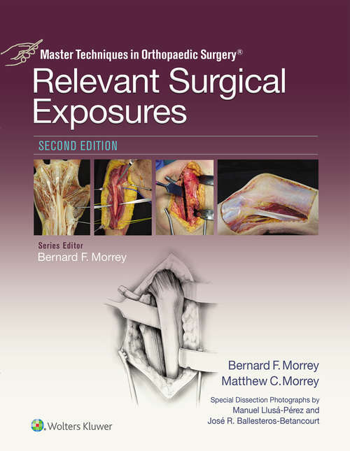 Book cover of Master Techniques in Orthopaedic Surgery: Relevant Surgical Exposures (2) (Master Techniques in Orthopaedic Surgery)