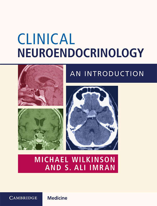 Clinical Neuroendocrinology: An Introduction