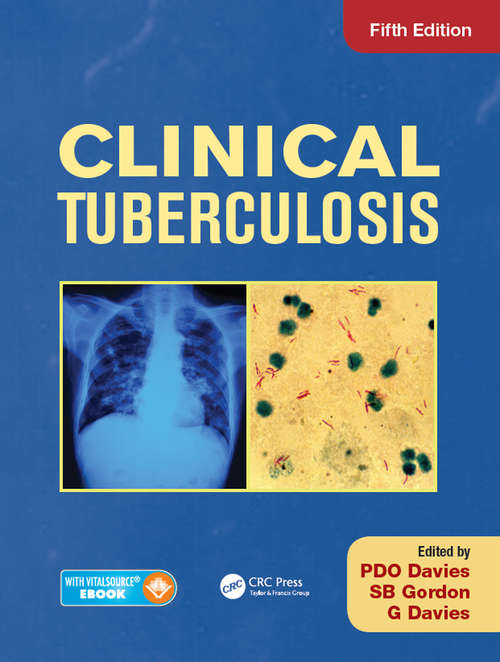 Clinical Tuberculosis: A Practical Handbook